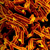 A Close Up of Bacteria a microscopic view of tubular bacteria